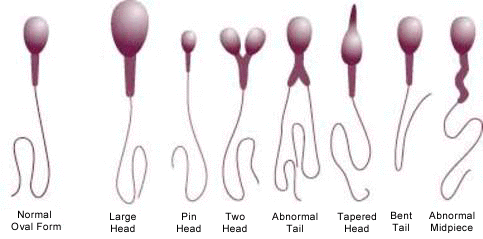 sperm_morphology